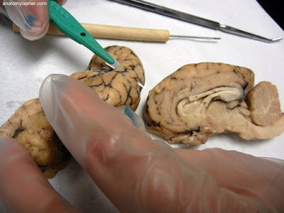 brain dissection cut sheep slice lab diagram below matter gray biologycorner labeled once structures made